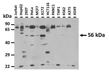 GLIS2 Rabbit Polyclonal Antibody