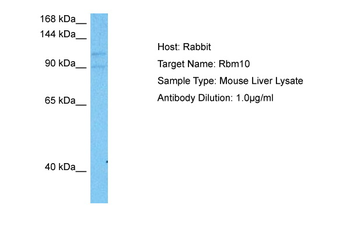 RBM10 Rabbit Polyclonal Antibody