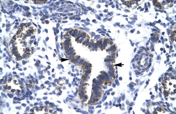 RBM10 Rabbit Polyclonal Antibody