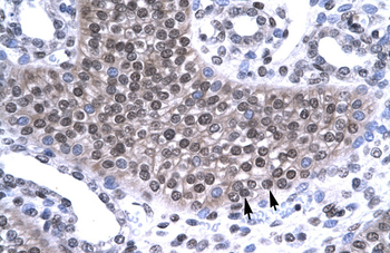 TAF15 Rabbit Polyclonal Antibody