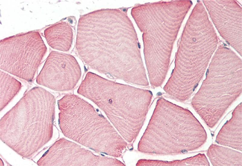 CDKN2C Rabbit Polyclonal Antibody