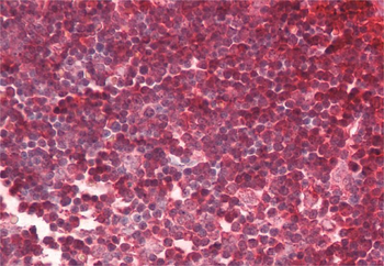 CDKN2C Rabbit Polyclonal Antibody