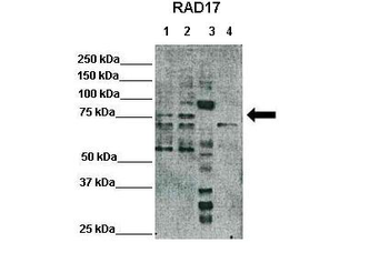 RAD17 Rabbit Polyclonal Antibody