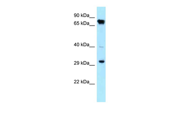 CDK4 Rabbit Polyclonal Antibody