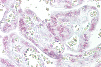 CHEK2 Rabbit Polyclonal Antibody