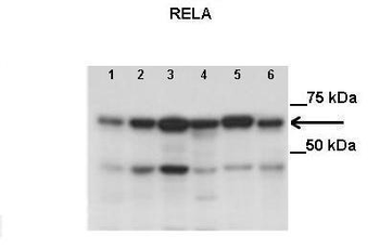 RELA Rabbit Polyclonal Antibody