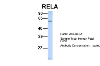 RELA Rabbit Polyclonal Antibody