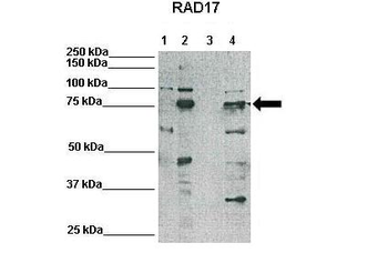 RAD17 Rabbit Polyclonal Antibody