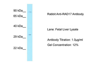 RAD17 Rabbit Polyclonal Antibody
