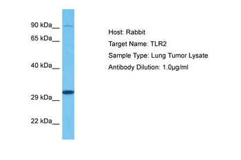 TLR2 Rabbit Polyclonal Antibody