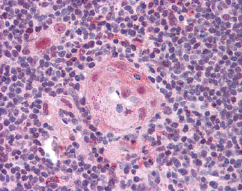 TLR2 Rabbit Polyclonal Antibody