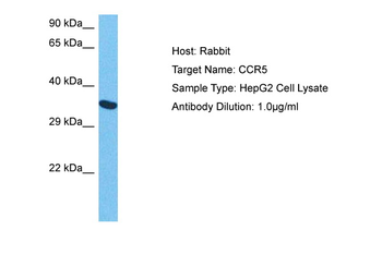 CCR5 Rabbit Polyclonal Antibody