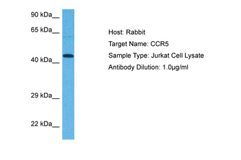 CCR5 Rabbit Polyclonal Antibody