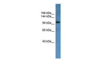 ZEB1 Rabbit Polyclonal Antibody