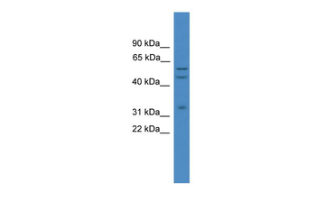 Elk1 Rabbit Polyclonal Antibody
