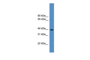 Pax2 Rabbit Polyclonal Antibody