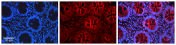 CEBPB Rabbit Polyclonal Antibody