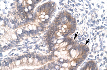 FOSL2 Rabbit Polyclonal Antibody