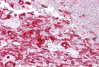 ATF1 Rabbit Polyclonal Antibody