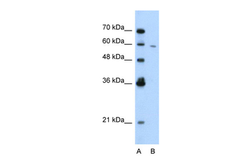 RIPK3 Rabbit Polyclonal Antibody