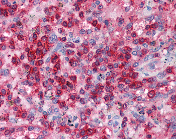 EAP30 Rabbit Polyclonal Antibody