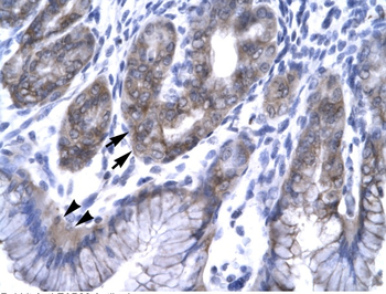 EAP30 Rabbit Polyclonal Antibody