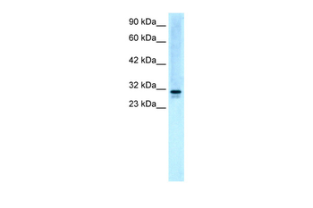 EAP30 Rabbit Polyclonal Antibody
