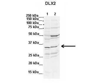 DLX2 Rabbit Polyclonal Antibody