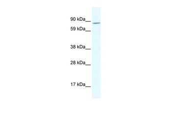 AHR Rabbit Polyclonal Antibody
