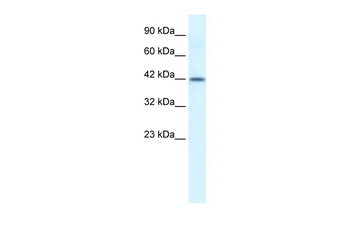 ESR2 Rabbit Polyclonal Antibody