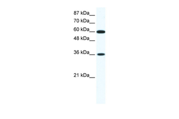 FOXF1 Rabbit Polyclonal Antibody