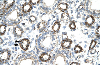 FOXF2 Rabbit Polyclonal Antibody