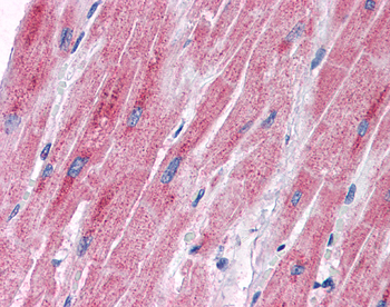 PDK2 Rabbit Polyclonal Antibody