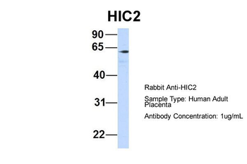 HIC2 Rabbit Polyclonal Antibody