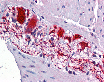SSBP2 Rabbit Polyclonal Antibody