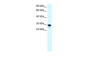 SSBP2 Rabbit Polyclonal Antibody
