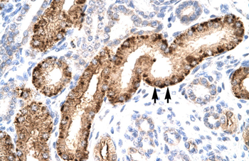 NR5A1 Rabbit Polyclonal Antibody