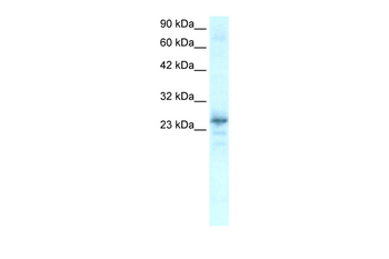 NKX2-8 Rabbit Polyclonal Antibody