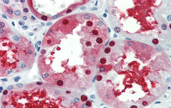 GATA3 Rabbit Polyclonal Antibody