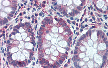 GATA6 Rabbit Polyclonal Antibody