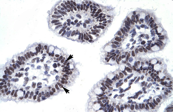 AATF Rabbit Polyclonal Antibody