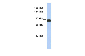 GRM6 Rabbit Polyclonal Antibody