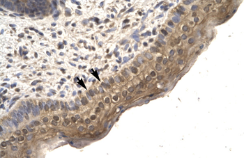 TFCP2L1 Rabbit Polyclonal Antibody
