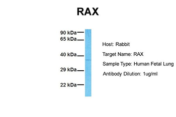 RAX Rabbit Polyclonal Antibody