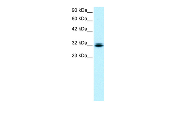 RAX Rabbit Polyclonal Antibody