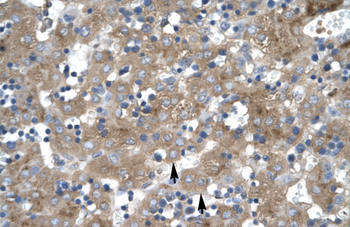 ZNF81 Rabbit Polyclonal Antibody