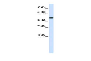 CNOT2 Rabbit Polyclonal Antibody