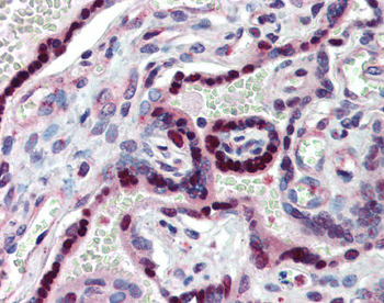 NR2E1 Rabbit Polyclonal Antibody
