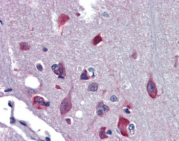NR2E1 Rabbit Polyclonal Antibody