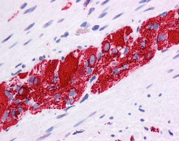 NR2E1 Rabbit Polyclonal Antibody